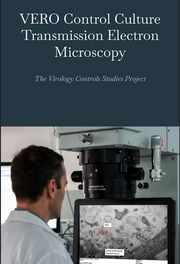 Vero Control: Viruses vs Cellular Debris - HISTORY-MAKING EXPERIMENT! (eBook by Jamie Andrews)